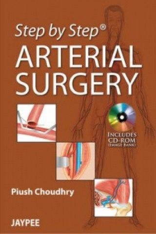 Kniha Step by Step: Arterial Surgery Piush Choudhry