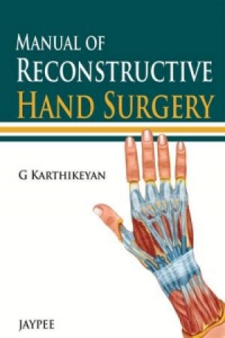 Carte Manual of Reconstructive Hand Surgery G Karthikeyan