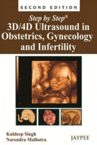 Kniha Step by Step: 3D/4D Ultrasound in Obstetrics, Gynecology and Infertility Kuldeep Singh