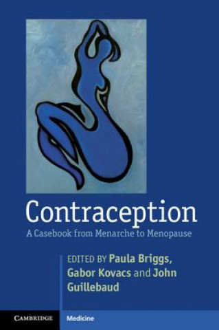 Könyv Contraception Paula Briggs & Gabor Kovacs