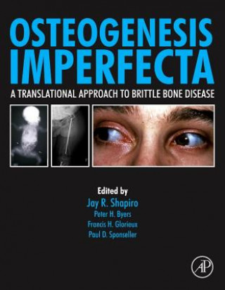 Könyv Osteogenesis Imperfecta Jay Shapiro
