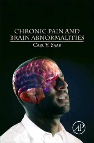 Book Chronic Pain and Brain Abnormalities Carl Saab