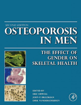 Könyv Osteoporosis in Men Eric S Orwoll