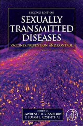 Knjiga Sexually Transmitted Diseases Lawrence R. Stanberry