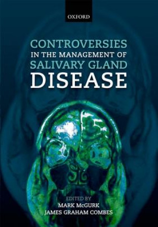 Könyv Controversies in the Management of Salivary Gland Disease Mark McGurk