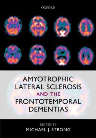 Kniha Amyotrophic Lateral Sclerosis and the Frontotemporal Dementias Michael J. Strong