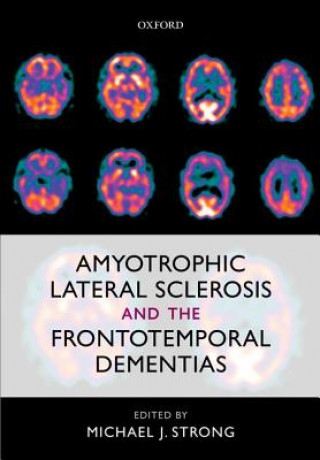 Książka Amyotrophic Lateral Sclerosis and the Frontotemporal Dementias Michael J. Strong