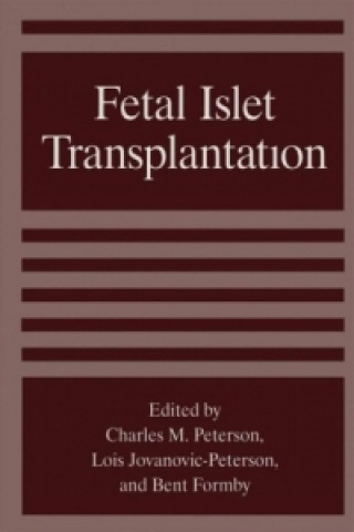 Book Fetal Islet Transplantation B. Formby