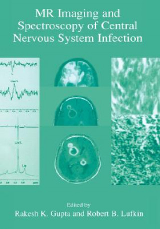 Kniha MR Imaging and Spectroscopy of Central Nervous System Infection Rakesh K. Gupta