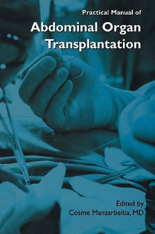 Kniha Practical Manual of Abdominal Organ Transplantation Cosme Manzarbeitia