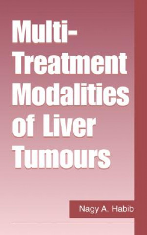 Carte Multi-Treatment Modalities of Liver Tumours Nagy A. Habib