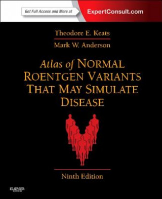 Książka Atlas of Normal Roentgen Variants That May Simulate Disease Theodore E. Keats