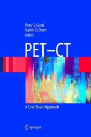 Carte Pet-Ct Peter S. Conti