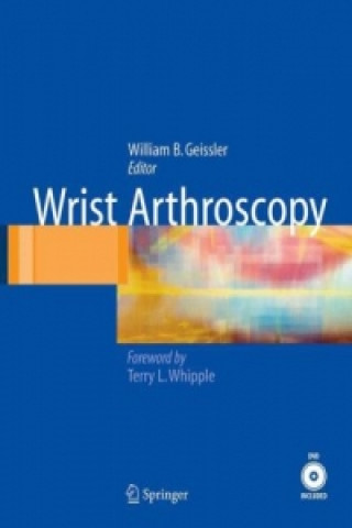Könyv Wrist Arthroscopy, w. DVD-ROM William B. Geissler