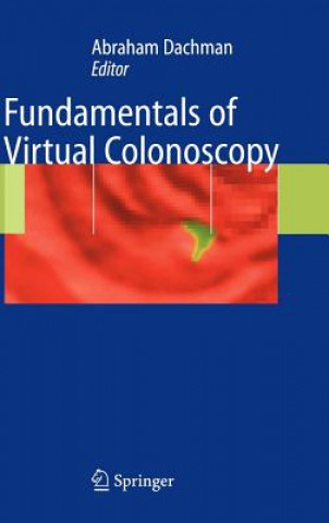 Kniha Fundamentals of Virtual Colonoscopy Abraham H. Dachman