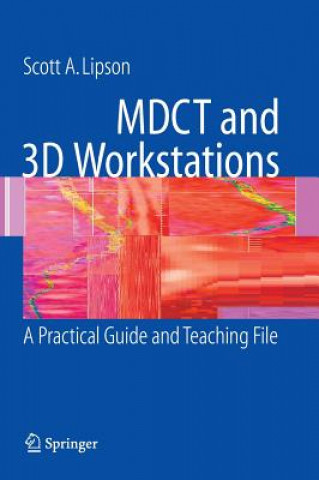 Книга MDCT and 3D Workstations Scott A. Lipson