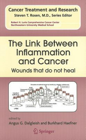 Könyv Link Between Inflammation and Cancer Angus G. Dalgleish