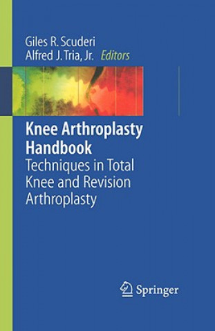 Carte Knee Arthroplasty Handbook Giles R. Scuderi