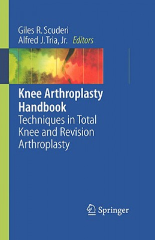 Книга Knee Arthroplasty Handbook Giles R. Scuderi