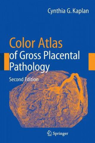 Könyv Color Atlas of Gross Placental Pathology C. G. Kaplan
