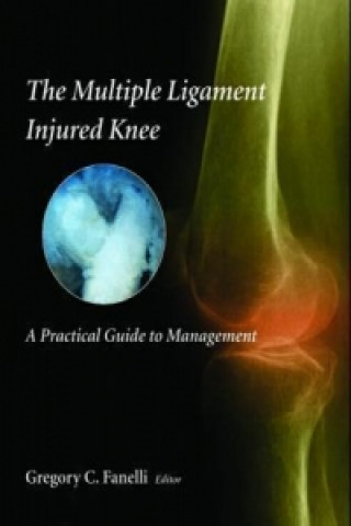 Carte The Multiple Ligament Injured Knee Gregory C. Fanelli