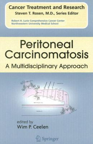 Kniha Peritoneal Carcinomatosis: A Multidisciplinary Approach Wim P. Ceelen