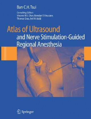 Knjiga Atlas of Ultrasound- and Nerve Stimulation-Guided Regional Anesthesia Ban C. H. Tsui