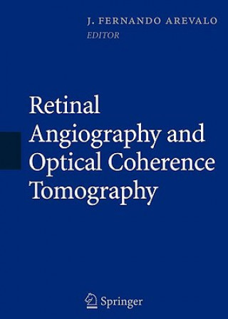 Carte Retinal Angiography and Optical Coherence Tomography J. Fernando Arevalo