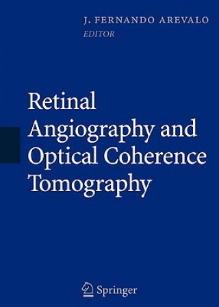 Libro Retinal Angiography and Optical Coherence Tomography J. Fernando Arevalo