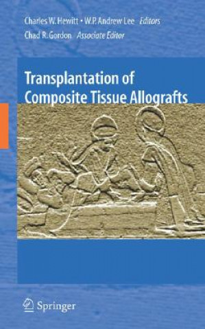 Βιβλίο Transplantation of Composite Tissue Allografts Charles W. Hewitt