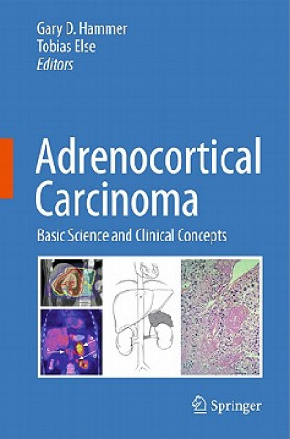 Könyv Adrenocortical Carcinoma Gary D. Hammer