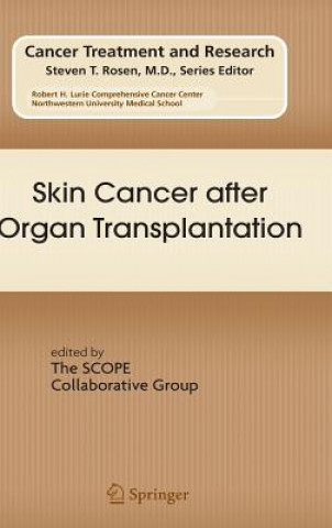 Kniha Skin Cancer after Organ Transplantation Eggert Stockfleth