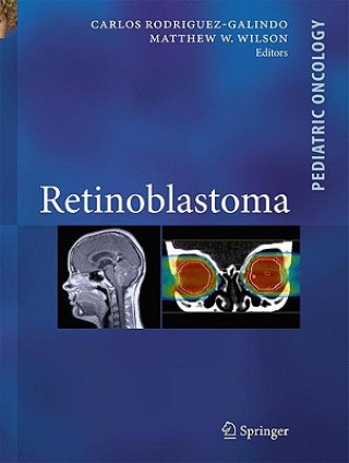 Carte Retinoblastoma Carlos Rodriguez-Galindo