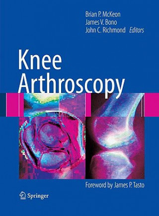 Carte Knee Arthroscopy Brian P. McKeon