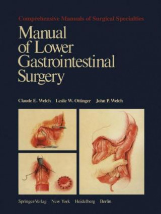 Könyv Manual of Lower Gastrointestinal Surgery Claude E. Welch
