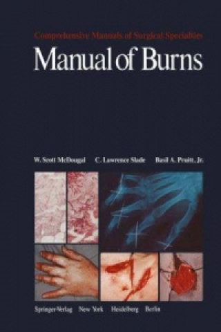Könyv Manual of Burns W.S. McDougal
