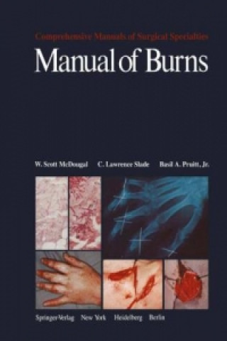 Kniha Manual of Burns W.S. McDougal