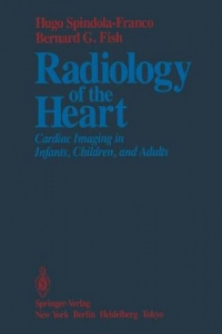 Kniha Radiology of the Heart Hugo Spindola-Franco