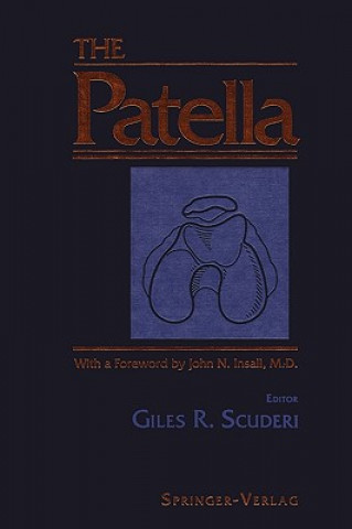 Buch Patella Giles R. Scuderi