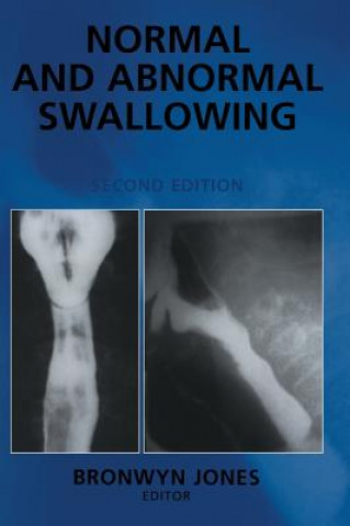 Carte Normal and Abnormal Swallowing Bronwyn Jones