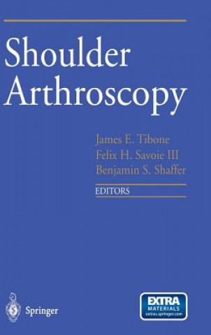 Książka Shoulder Arthroscopy James E. Tibone