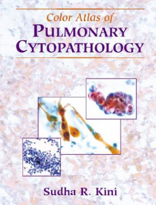 Kniha Color Atlas of Pulmonary Cytopathology Sudha R. Kini