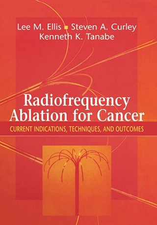 Kniha Radiofrequency Ablation for Cancer Lee M. Ellis