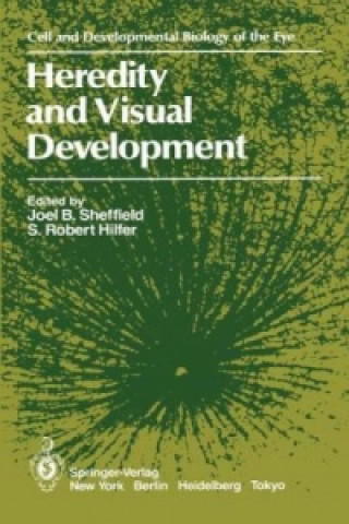 Carte Heredity and Visual Development Joel B. Sheffield