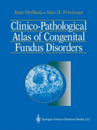 Carte Clinico-Pathological Atlas of Congenital Fundus Disorders Juan Orellana