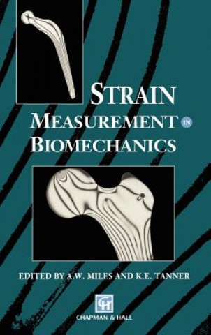 Carte Strain Measurement in Biomechanics A.W. Miles
