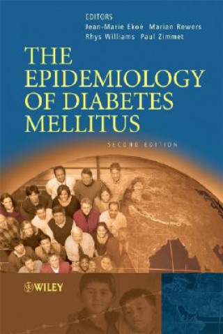 Carte Epidemiology of Diabetes Mellitus 2e Jean Marie Ekoé