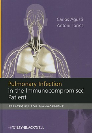 Könyv Pulmonary Infection in the Immunocompromised Patient Carlos Agusti