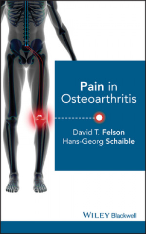 Kniha Pain in Osteoarthritis David T. Felson