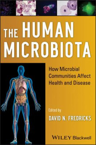 Könyv Human Microbiota - How Microbial Communities Affect Health and Disease David N. Fredricks